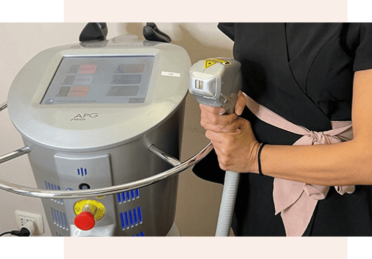 Epilazione definitiva con laser diodo 808